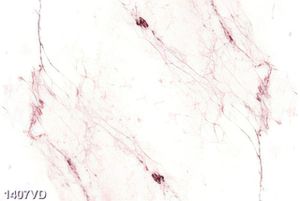 Đá trắng vân hồng