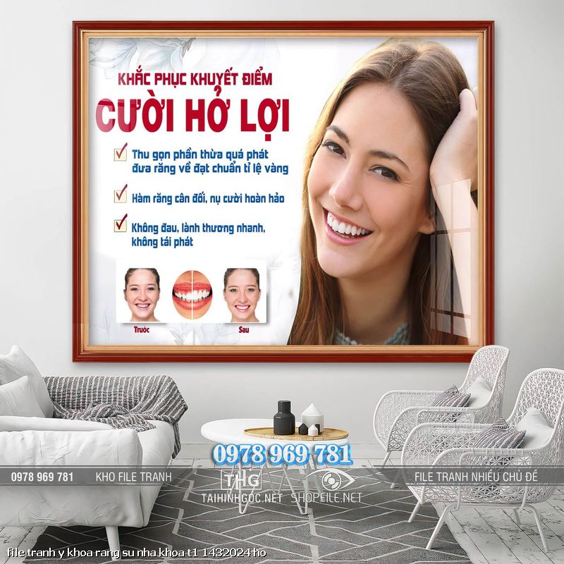 file tranh y khoa rang su nha khoa t1 1432024 ho